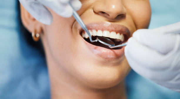 Best Emergency Wisdom Teeth Removal in Harwood Heights, IL